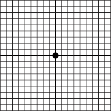 What is Age-related macular degeneration (AMD)